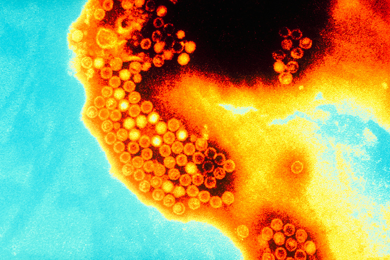 Illustration for article titled Psychedelic Images of Terrifying Viruses